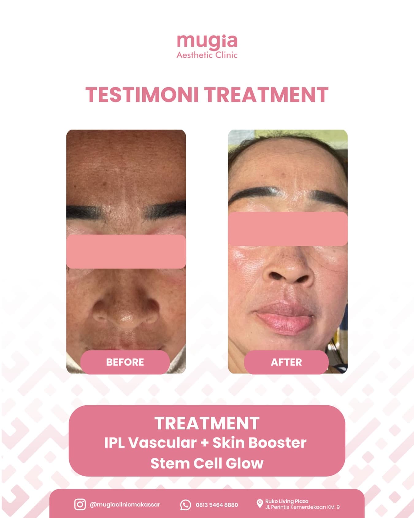 Skin Booster