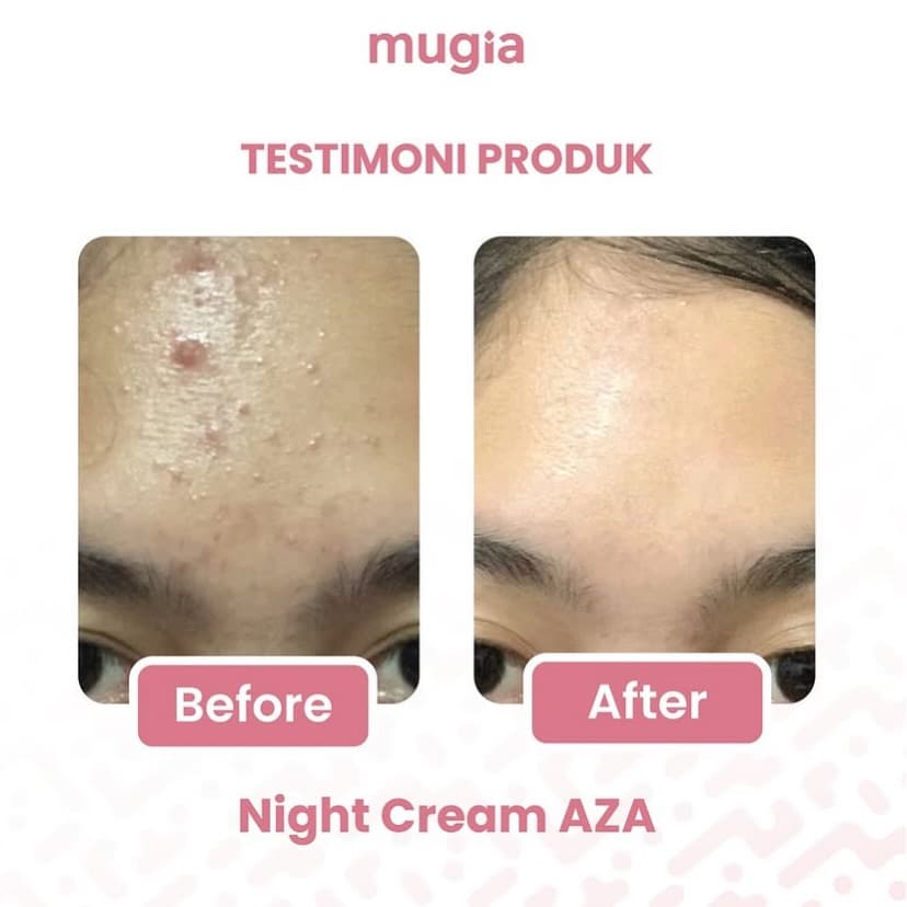 Meso Treatment